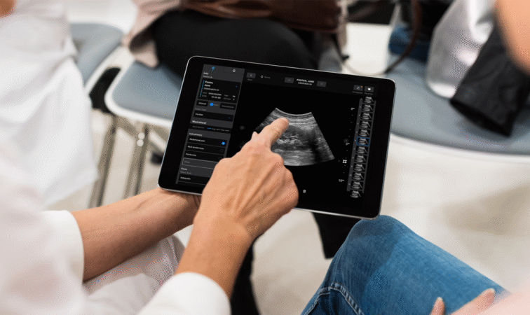 Samsung Eyes $100M Investment in Innovative Medical Imaging Startup Exo