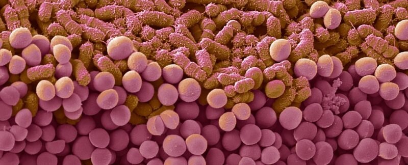 Yo-Yo Dieting: The Surprising Impact on Your Gut Bacteria